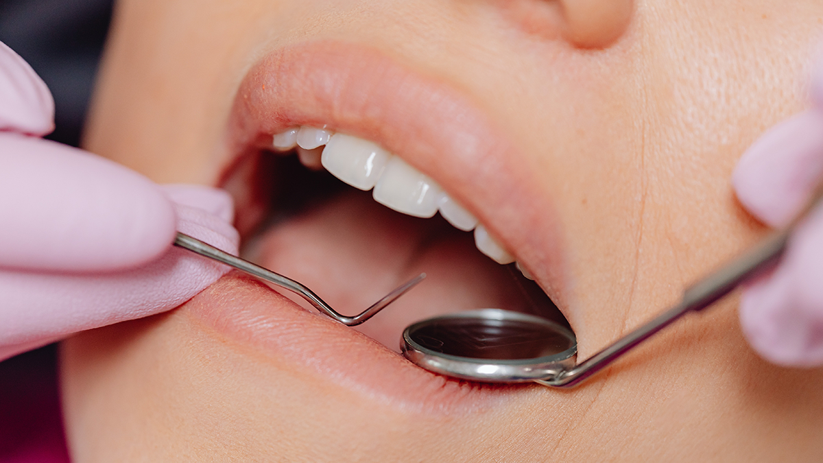 Wir erklären Ablauf und Nutzen der Professionellen Zahnreinigung (PZR)